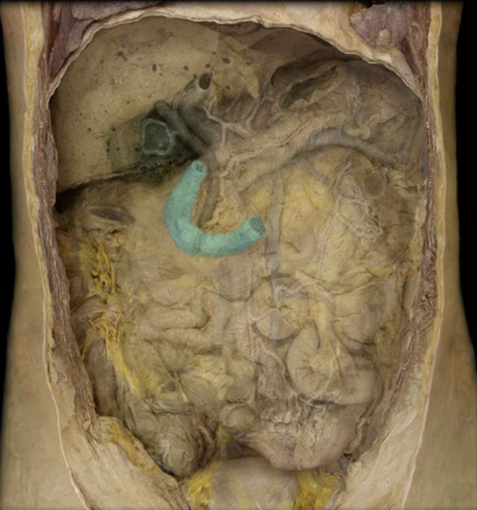 <p>What is the name of the organ highlighted? </p>