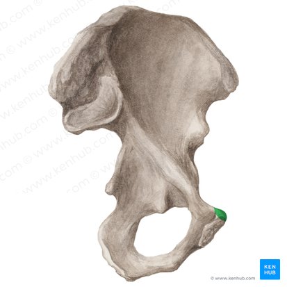 <p>What bone structure is this?</p>