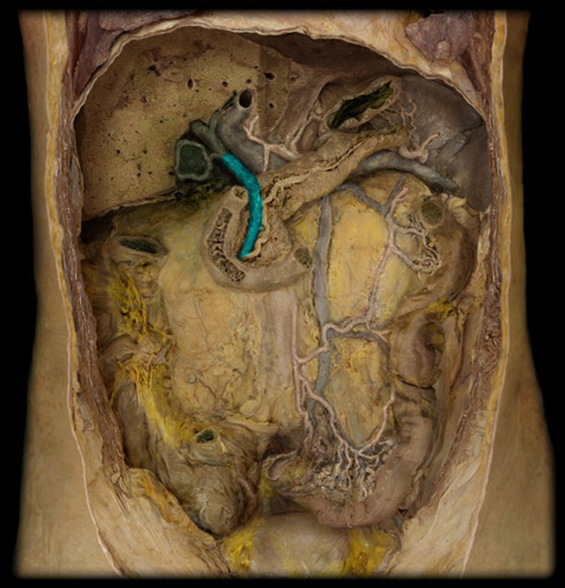 <p>Structure</p><p>- Comes off of cystic duct going down</p>