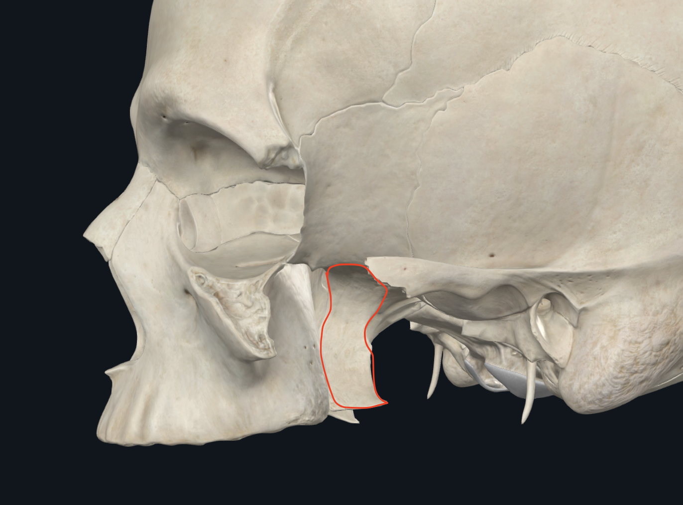 <p><strong>pared posterior de la hendidura pterigomaxilopalatina</strong></p>