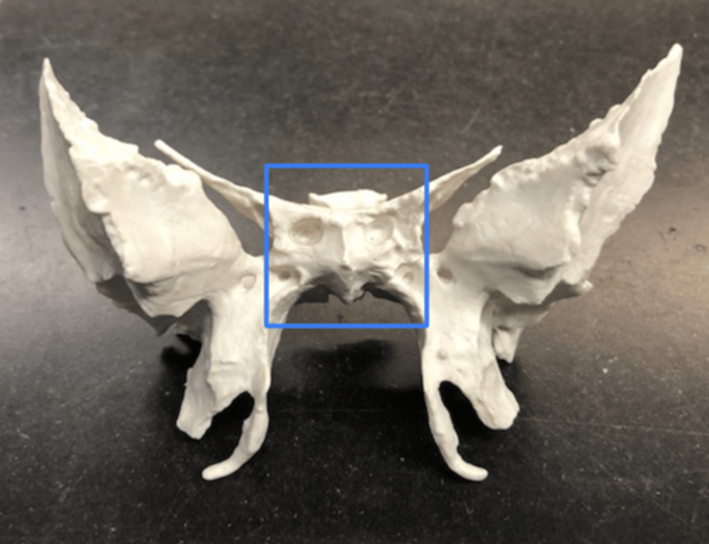 <p>Center of the sphenoid only</p>