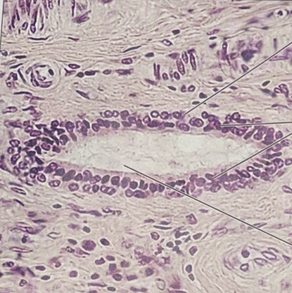 <p>stratified cuboidal</p>