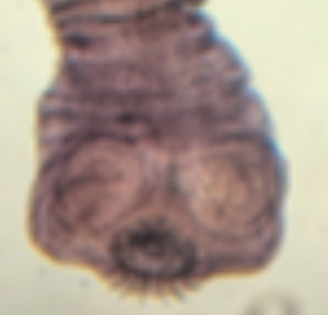 <p>the circular structures on this Taenia scolex is </p>