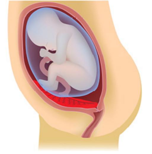 <p>What kind of placenta is shown?</p>