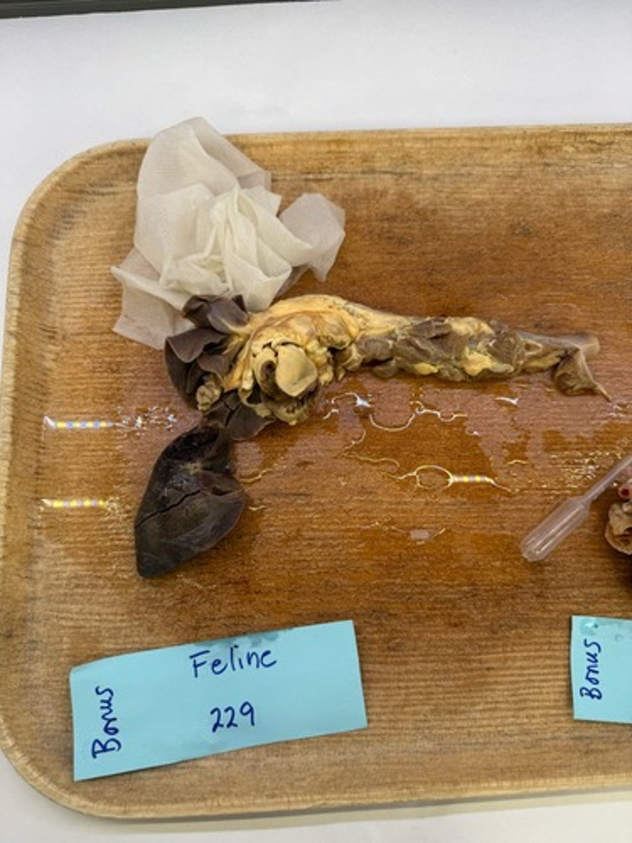 <p>What is this lesion?</p>