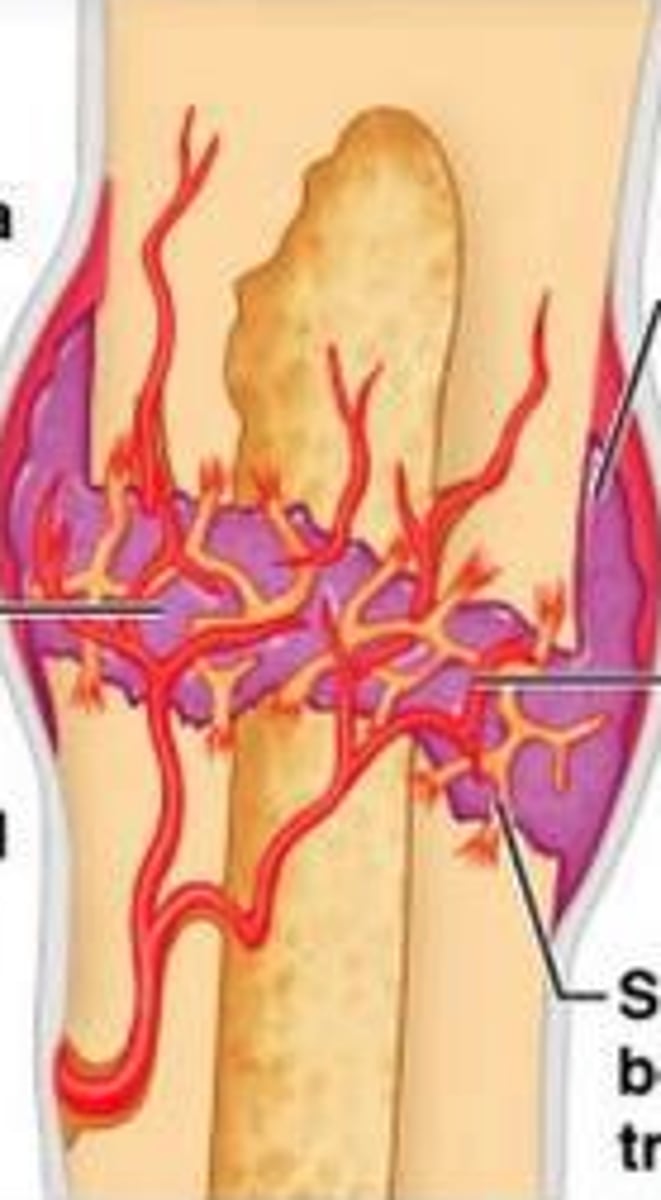 <p>blood vessels grow into clot in hematoma</p>
