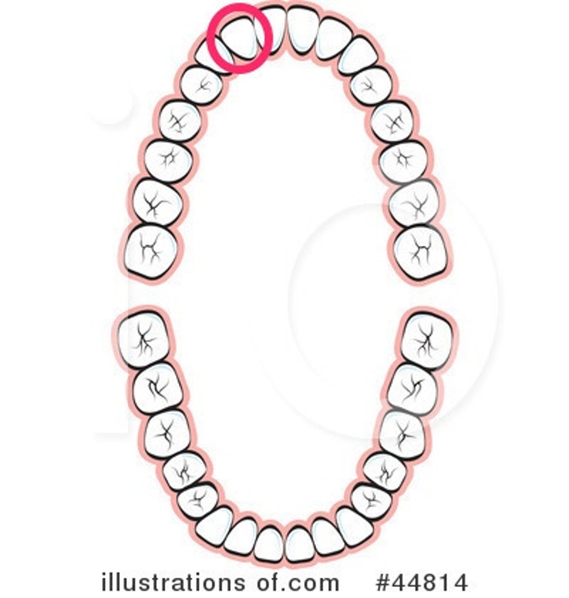 <p>UR lateral incisor</p>