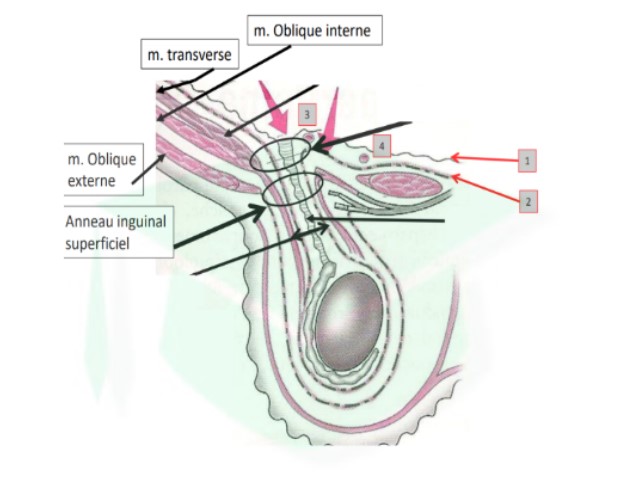 <ul><li><p>canal inguinal = canal oblique avant/dedans</p></li><li><p>fascia transversalis → s&apos;invagine à travers ce canal inguinal → derrière le grand droit de l&apos;abdomen, s&apos;infléchit dans le canal inguinal + fais le tour du testicule (homme) ou du ligament rond (femme)</p></li></ul>