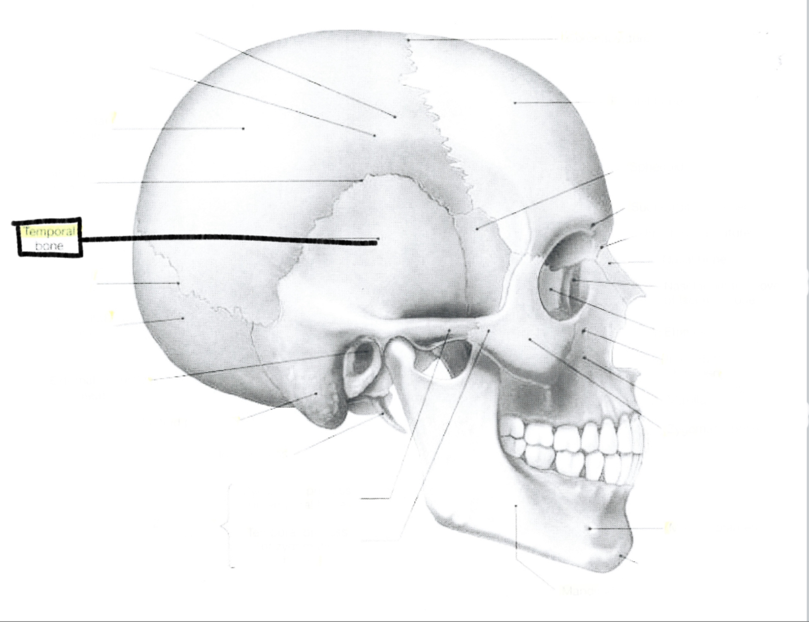 <p>Temporal bone</p>