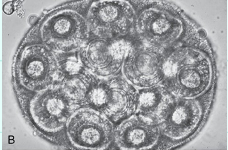 <p>What egg type?</p>