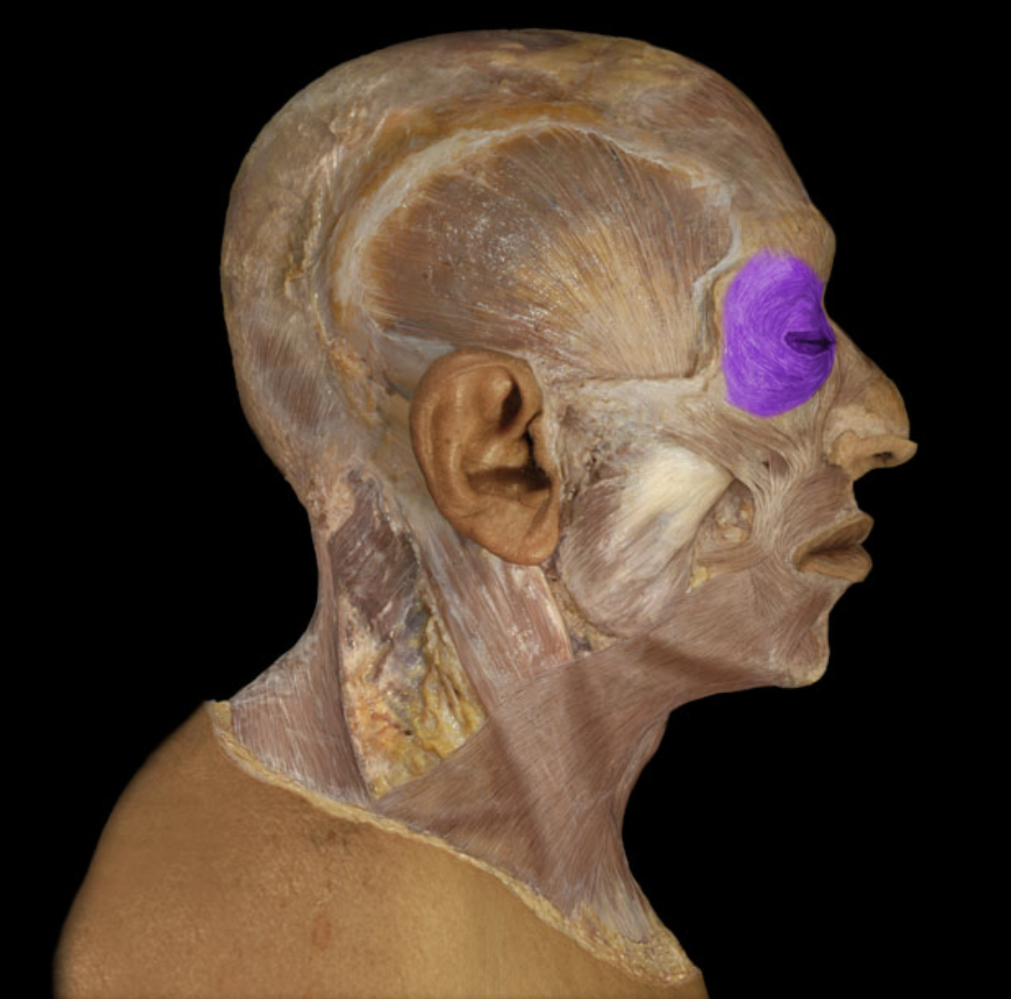 <p>What is/are this muscle’s origin(s)?</p>