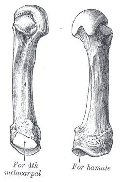 <p>Metacarpal that bears only 2 basal (at the bottom/base) facets and can be identified by the ridge on the dorsal side</p>
