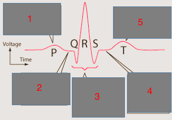 Beginning of ventricle repolarization, should be flat--when does this occur?
