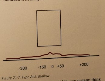 <ul><li><p>Shallow; poorly compliant middle ear system.</p></li><li><p>Think: TM scarring, TM sclerosis, otosclerosis, or ossicular fixation.</p></li><li><p>Compliance curve is in the normal position (x-axis), but peak compliance is very low (< 0.2 cc)</p></li><li><p>NOT due to middle ear effusion!</p></li><li><p>Conductive hearing loss</p></li></ul>