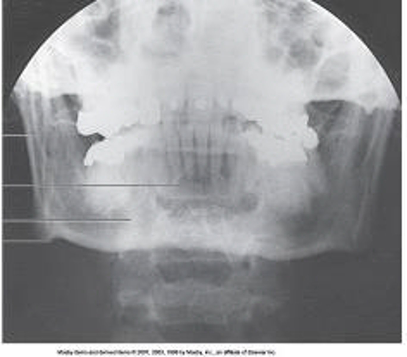 <p>What projection and anatomy is demonstrated?</p>