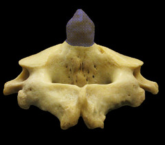 tooth