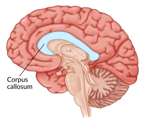 Corpus Callosum