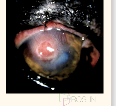 <p>cause of cornela ulcer</p>