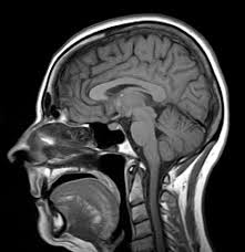 <p>MRI (Magnetic Resonance Imaging)</p>