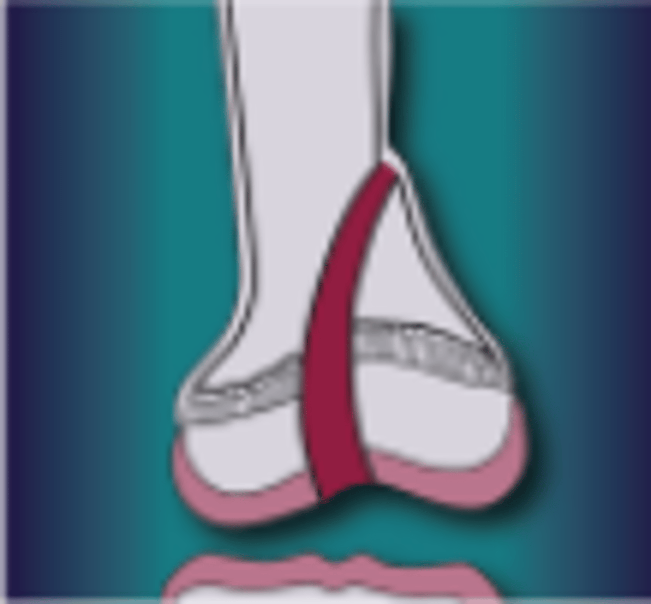 <p>What injury is this</p>