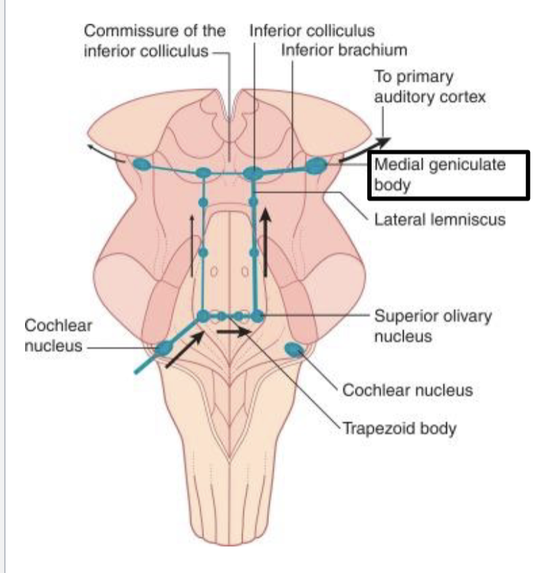 <p>what is the function of the medial geniculate body?</p>