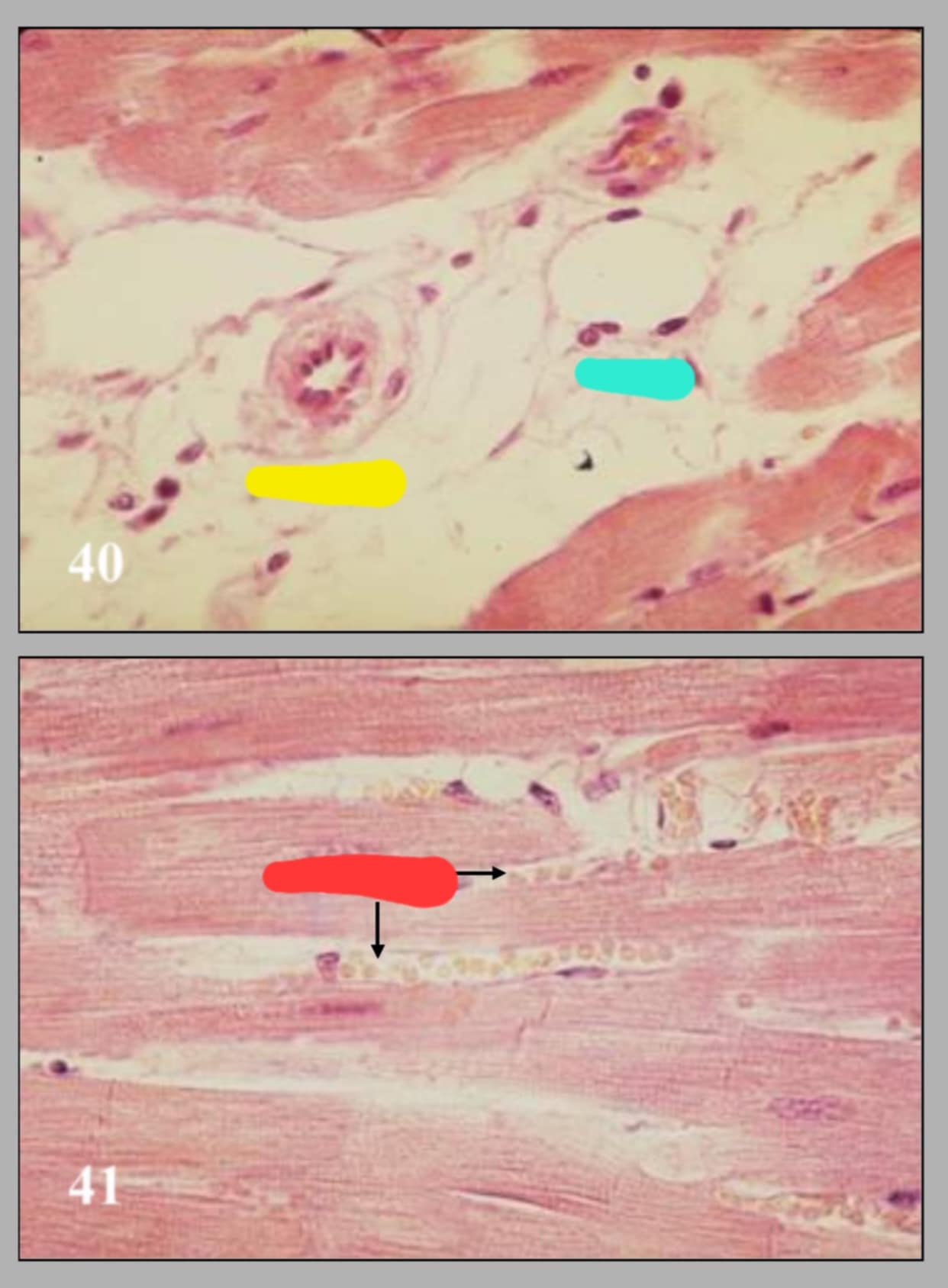 <p>name of these 2 slides and their parts.</p>