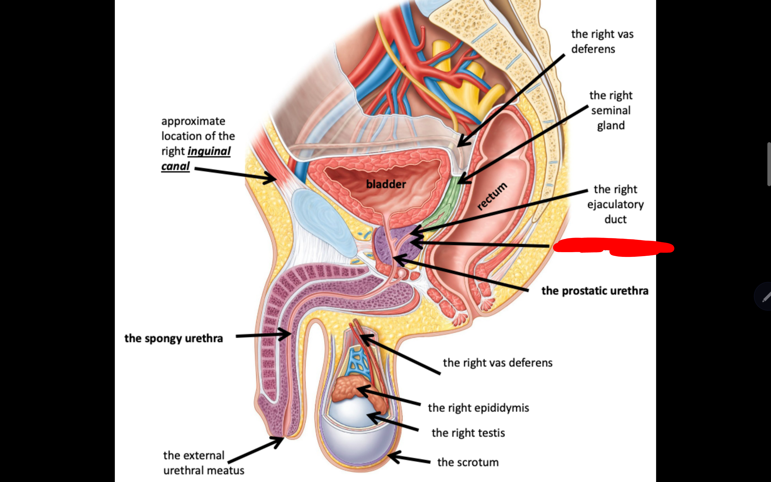 <p>Name the structure in red</p>