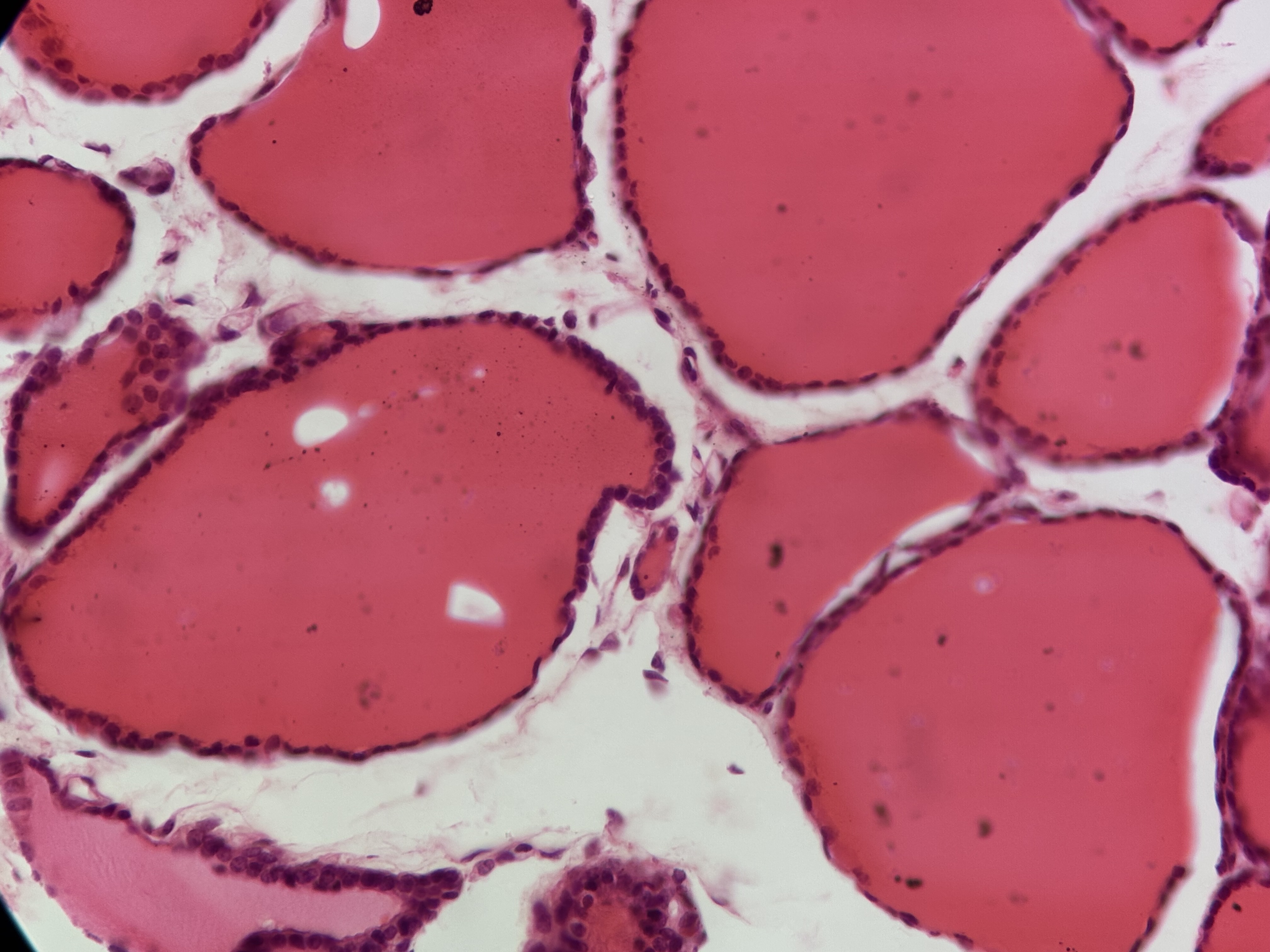<p>single layer cube like cell large nuclei </p><p>function: absorption </p>