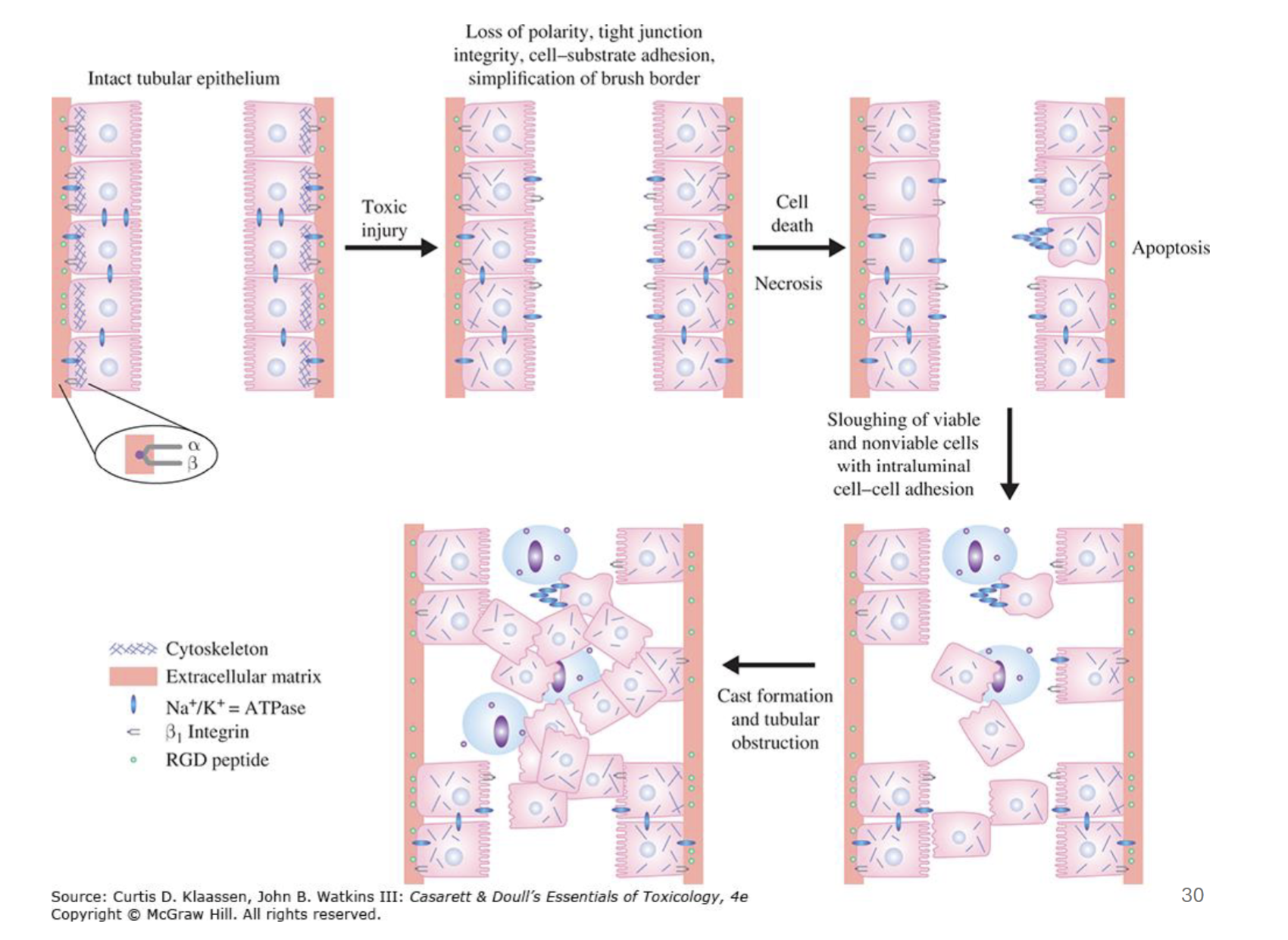 <p>Toxic injury leads to cell death → loss of concentration gradient, leading to backflow in tubules </p><p>Death of cells detaches them from basal layer → macrophages try to clear debris → tubular obstruction → increased luminal pressure → backflow? </p>