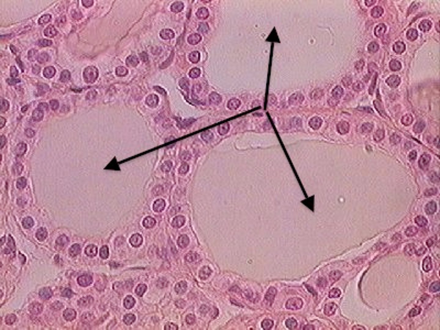 <p>Colloid</p>