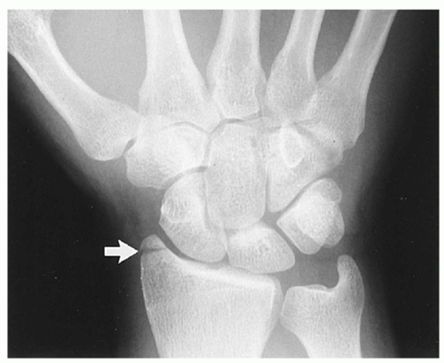 <p>Hutchinson's fx</p>