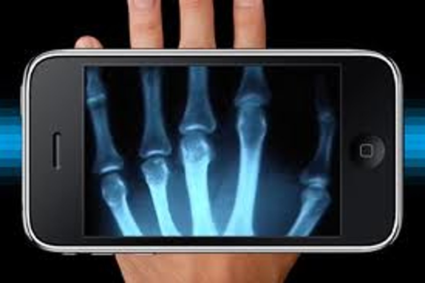 <p>X-ray</p>