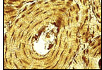 <p>“osseous tissue“ — provides framework and strength for body; allows movements; stores calcium; contains blood forming cells</p>