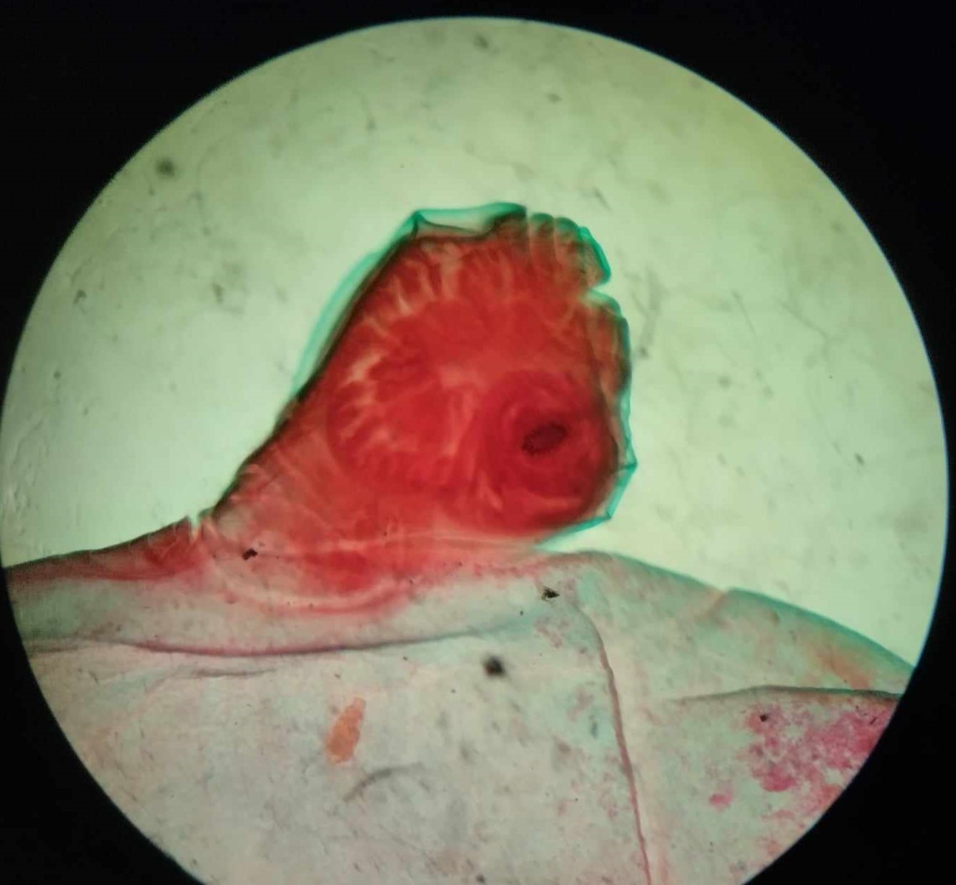 <p>name of larval stage and of which parasite?</p>
