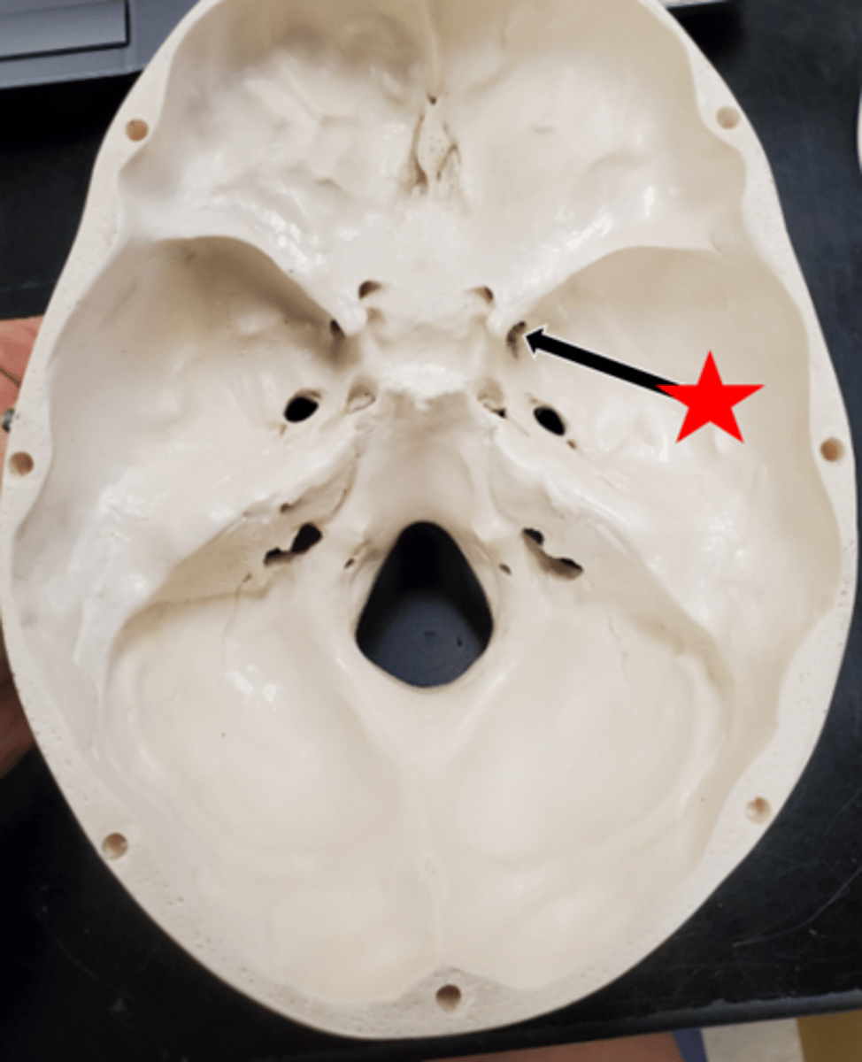 <p>Name the starred region in the image.</p>