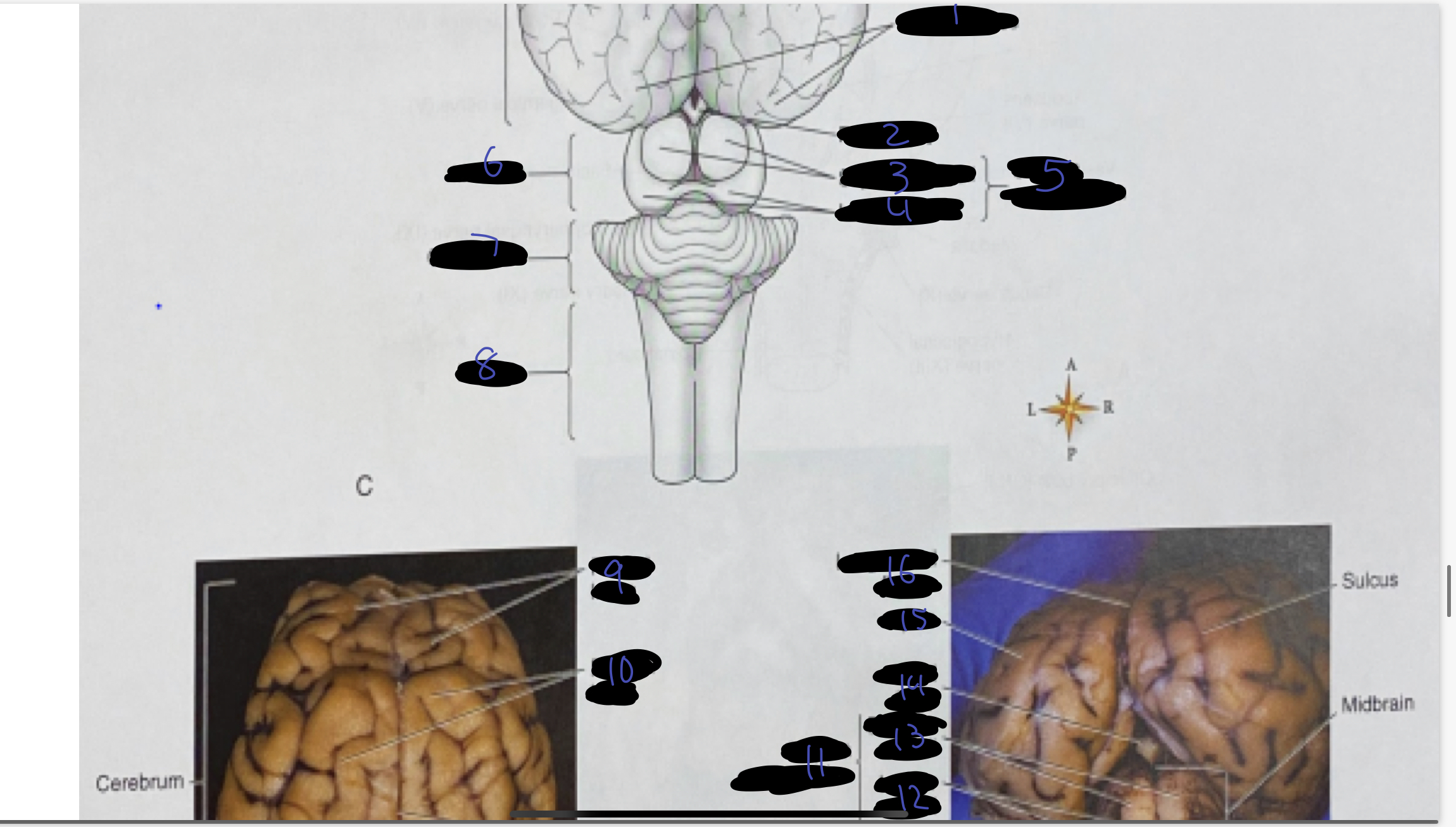 <ol><li><p>occipital lobes</p></li><li><p>pineal body</p></li><li><p>superior colliculi</p></li><li><p>inferior colliculi</p></li><li><p>corpora quadrigemina</p></li><li><p>midbrain</p></li><li><p>cerebellum</p></li><li><p>medulla</p></li><li><p>frontal lobe</p></li><li><p>parietal lobe</p></li><li><p>corpora quadrigemina</p></li><li><p>inferior colliculi</p></li><li><p>superior colliculi</p></li><li><p>pineal body</p></li><li><p>gyrus</p></li><li><p>longitudinal fissure</p></li></ol>