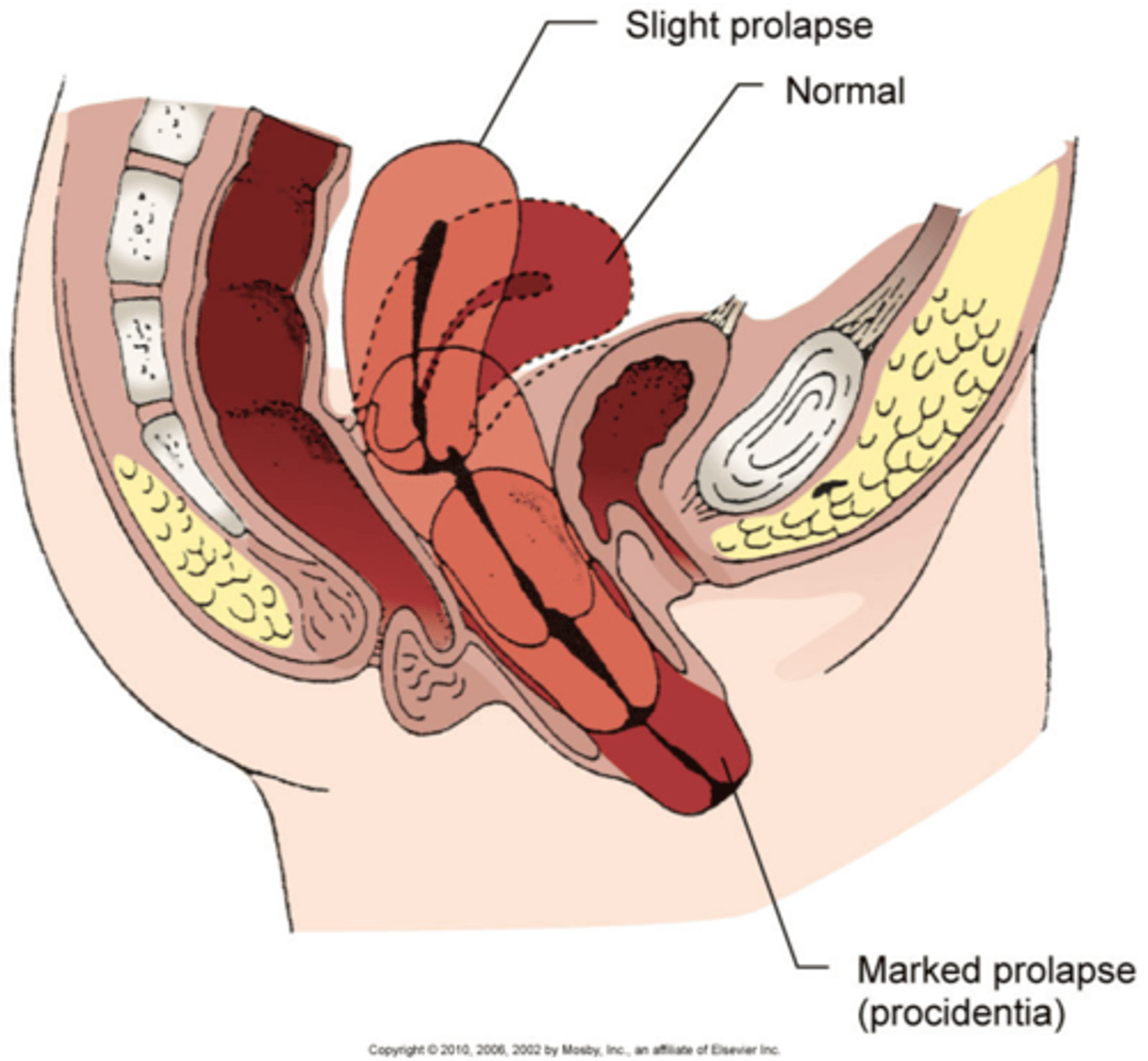 <p>when projects into vagina</p>