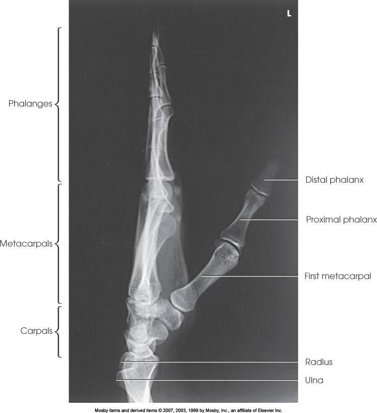 <p>What position is demonstrated?</p>