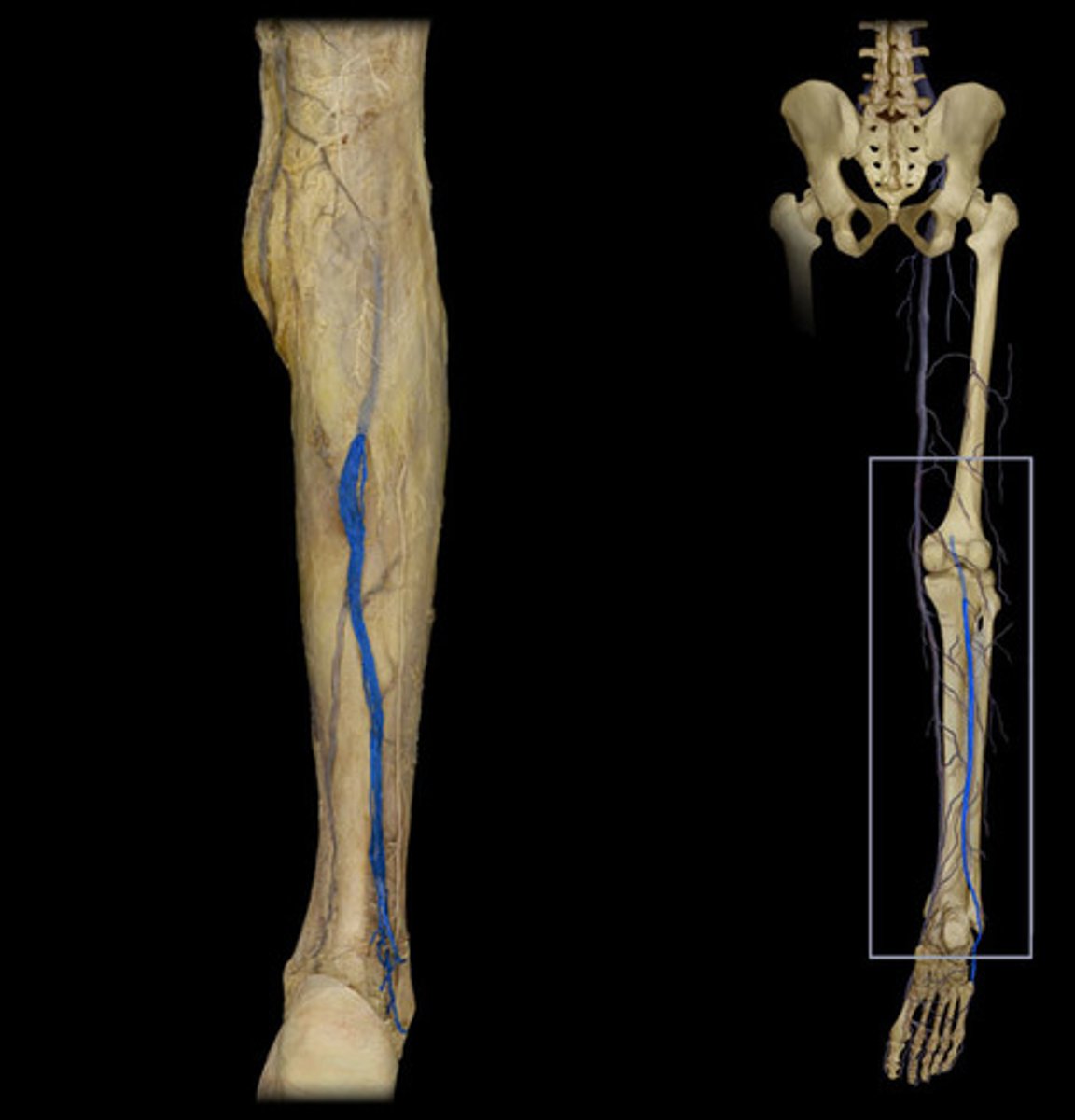 <p>A: Small saphenous vein</p>