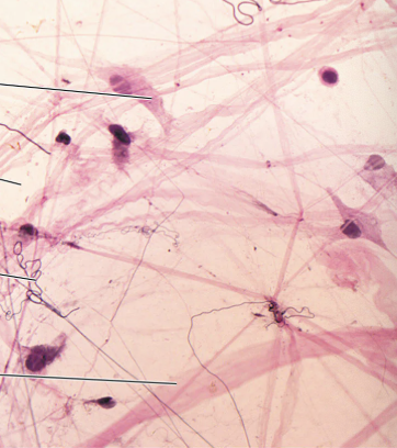 <p>what type of connective tissue is this?</p>