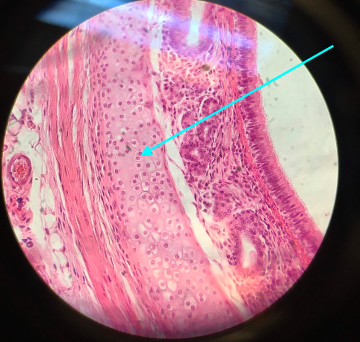 <p>This is a slide depicting the trachea. What type of tissue is the blue arrow pointing at?</p>