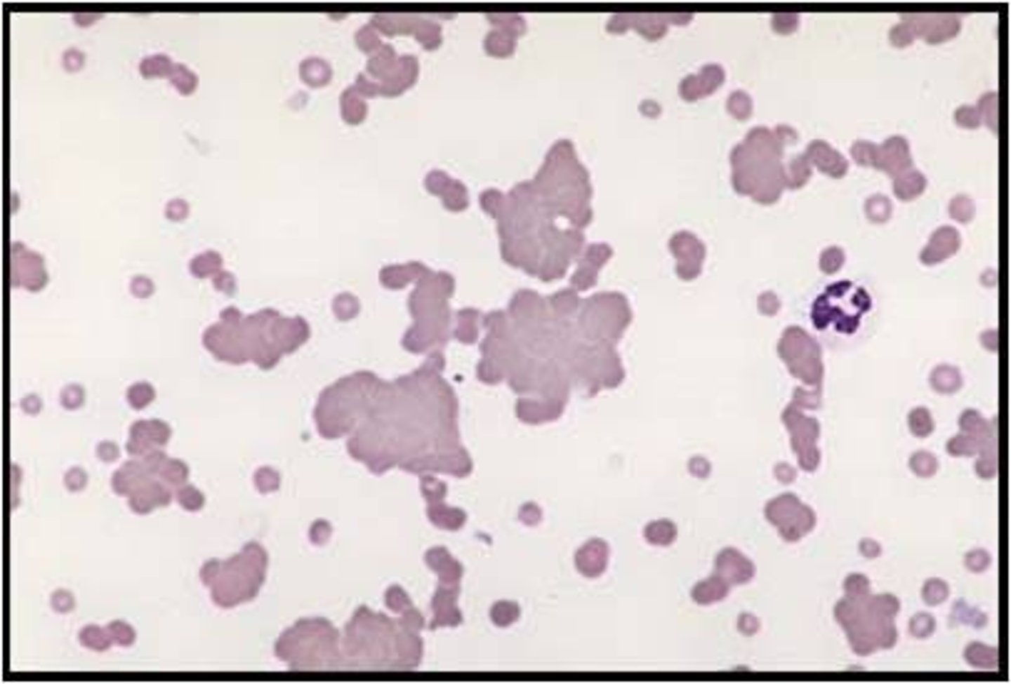 <p>clumping of red blood cells</p>