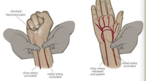 <p><span style="font-family: Calibri, sans-serif">Done prior to arterial line/ABG (arterial blood gas) to confirm collateral circulation&nbsp;</span></p>