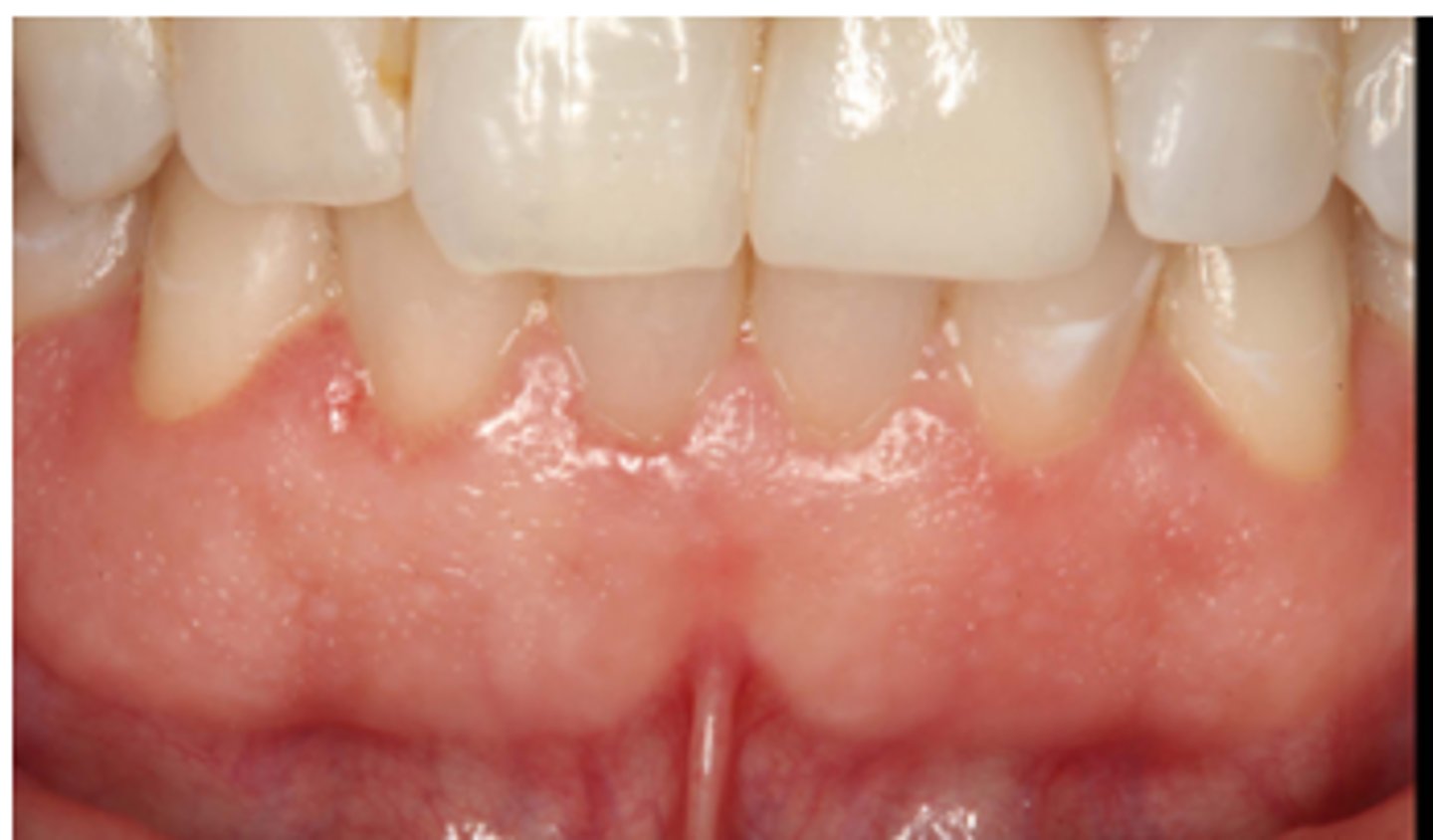 <p>Describe the teeth shape and gum type:</p><p>• ______ shaped teeth</p><p>• ____ gums</p>