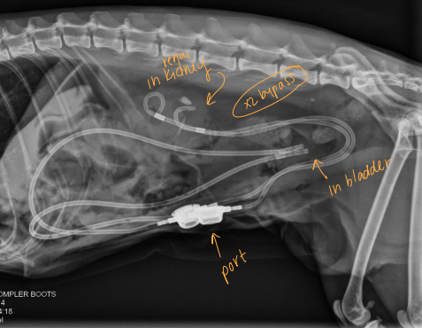 <p><span>Ureteral Surgical Procedures</span></p>