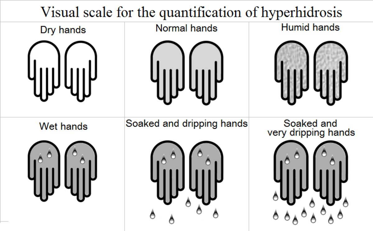 <p>E: primary cortex (waking hours only)<br>thyroid</p><p>CM: excessive sweating<br>symmetric<br>bilateral<br>waking hours only→primary cortical<br>-axillae<br>-palms<br>-soles<br>-face (rare)</p><p>DX: thyroid panel</p><p>TX: aluminum chloride antiperspirants<br>aluminum chloride hexahydrate<br>PO glycopyrrolate (long term use→dementia)<br>botulinum toxin injections x 3-6 months</p>