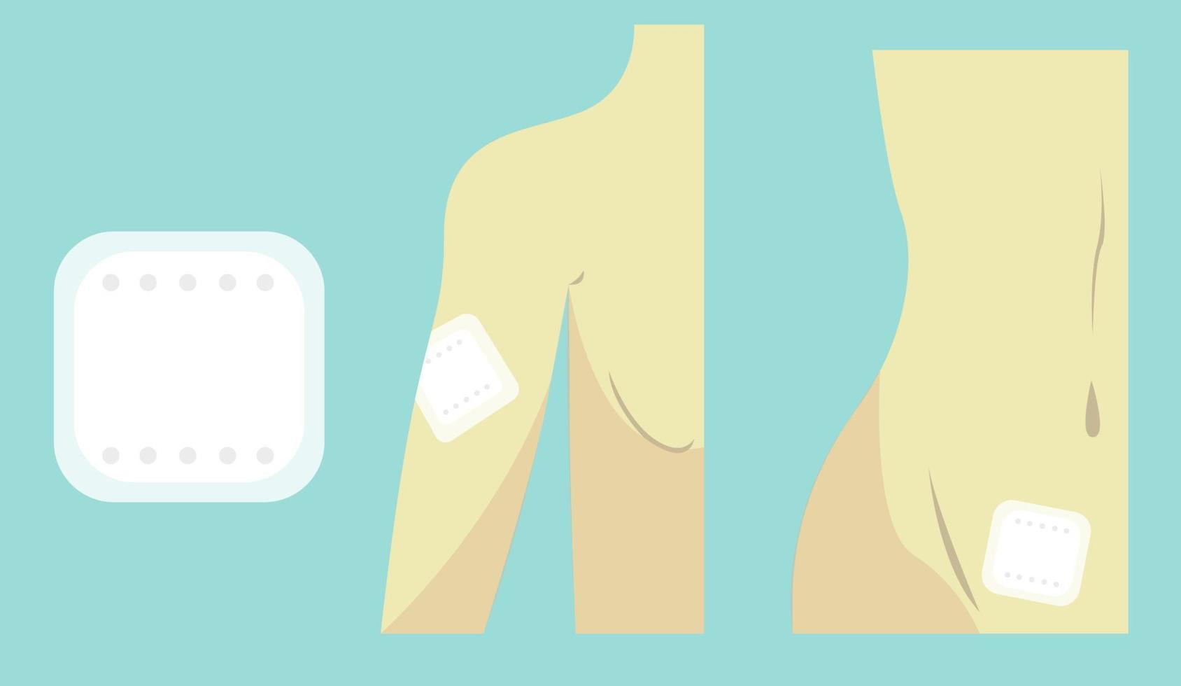 <p>verminderen van vruchtbaarheid (hormonaal)</p><ul><li><p>de anticonceptiepleister</p></li></ul><p></p>