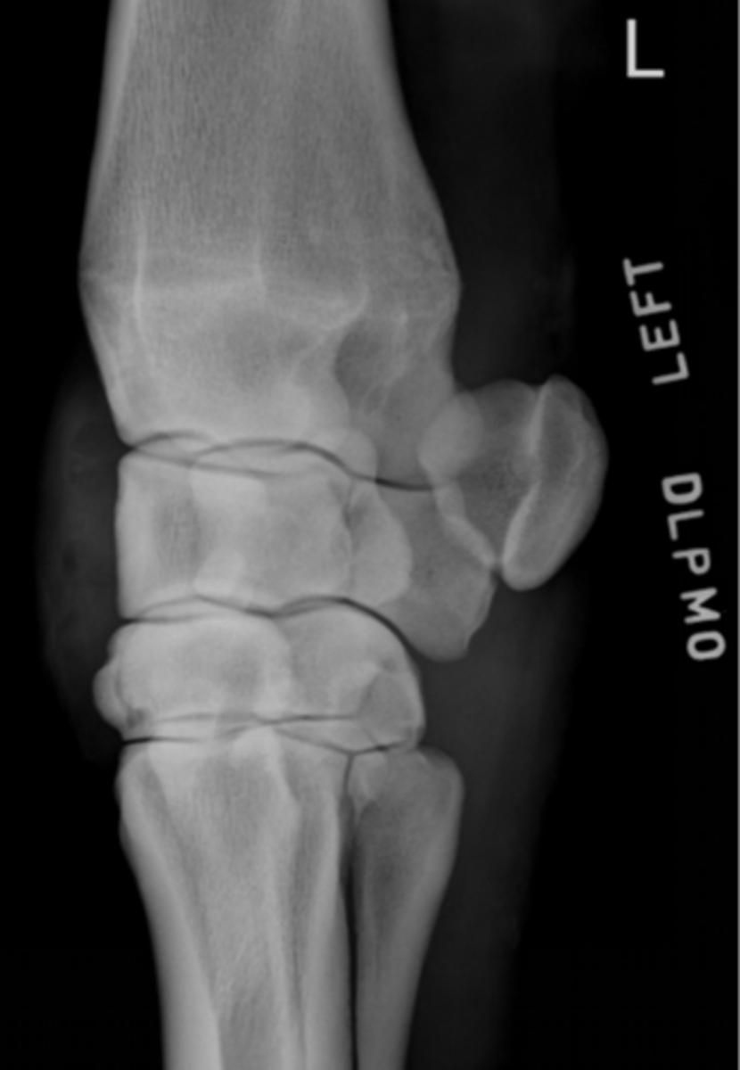 <p>Which metacarpal bone is superimposed with metacarpal 3 in a DLPMO?</p>