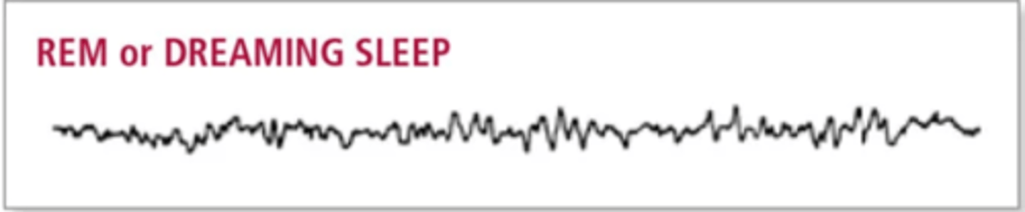 <p>(D) REM</p><p>REM is a stage of sleep that is characterized by rapid eye movement, however most of one's muscles are paralyzed. The most dreaming occurs in this stage of sleep and it is the most important stage of sleep for memory consolidation.</p>