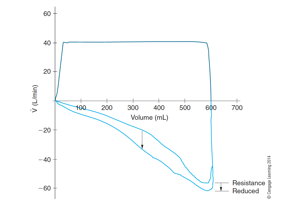 <p>On a flow-volume loop, the expiratory flow is _______ the horizontal (volume) axis and it is usually _______ following a successful bronchodilator therapy.</p>